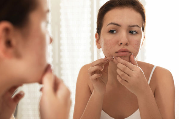 5 Surprising Everyday Items That Cause Breakouts